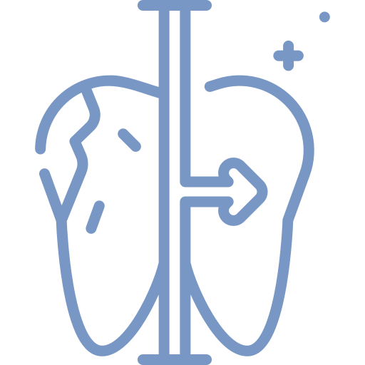 Dental Restoration -tooth filling and composite tooth filling