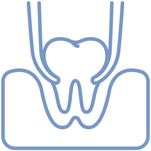 wisdom teeth removal